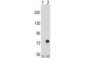 Western blot analysis of TGFBI antibody and 293 cell lysate either nontransfected (Lane 1) or transiently transfected (2) with the TGFBI gene. (TGFBI Antikörper  (AA 106-135))