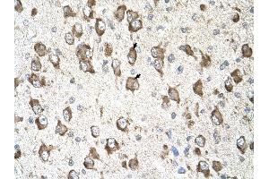 SLC26A8 antibody was used for immunohistochemistry at a concentration of 4-8 ug/ml to stain Neural cells (arrows) in Human Brain. (SLC26A8 Antikörper  (C-Term))