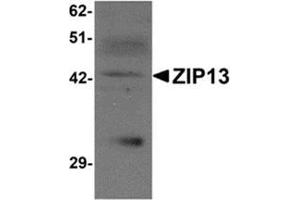 Western blot analysis of ZIP13 in K562 cell lysate with ZIP13 antibody at 1 μg/ml. (SLC39A13 Antikörper  (N-Term))