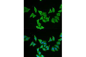 Immunofluorescence analysis of U2OS cells using MLN antibody (ABIN5973790). (Motilin Antikörper)