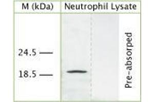 WB on human neutrophil lysate using Sheep antibody to human Cathelicidin antimicrobial peptide (CAP-18, hCAP-18, antibacterial protein LL-37, CAMP, CRAMP, FALL39): IgG (ABIN350187) at 50 µg/ml concentration. (Cathelicidin Antikörper)