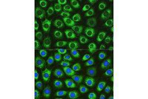 Immunofluorescence analysis of L929 cells using DN Rabbit pAb (ABIN6130306, ABIN6139717, ABIN6139719 and ABIN6215728) at dilution of 1:100. (DNAJC10 Antikörper  (AA 614-793))