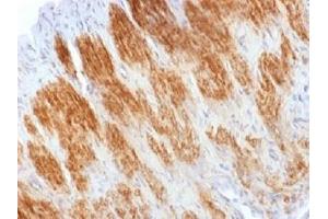 IHC testing of FFPE rat uterus stained with Calponin antibody.