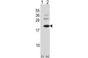 Western Blotting (WB) image for anti-BARX Homeobox 1 (BARX1) antibody (ABIN2998377) (BARX1 Antikörper)