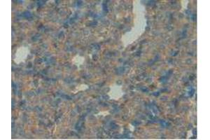 IHC-P analysis of Rat Spleen Tissue, with DAB staining. (IGFBP7 Antikörper  (AA 88-281))