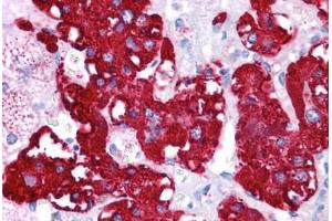 Immunohistochemistry (Formalin-fixed Paraffin-embedded Sections) (IHC (fp)) image for anti-Nuclear Receptor Subfamily 4, Group A, Member 2 (NR4A2) (N-Term) antibody (ABIN6745718)