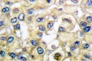 Image no. 1 for anti-Fibroblast Growth Factor Receptor 2 (FGFR2) antibody (ABIN265417) (FGFR2 Antikörper)