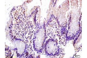 Formalin-fixed and paraffin embedded rat colon labeled with Anti-FOXN1 Polyclonal Antibody, Unconjugated (ABIN1387592) at 1:200 followed by conjugation to the secondary antibody and DAB staining (FOXN1 Antikörper  (AA 321-420))