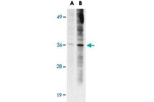 Western blot analysis of ST3GAL6 in HeLa cell lysate with ST3GAL6 polyclonal antibody  at (A) 1 and (B) 2 ug/mL . (ST3GAL6 Antikörper  (C-Term))