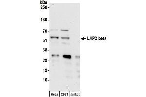 Western Blotting (WB) image for anti-LAP2 beta gamma/tmpo (AA 404-454) antibody (ABIN7453457) (LAP2 beta gamma/tmpo (AA 404-454) Antikörper)