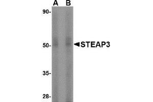 Western Blotting (WB) image for anti-STEAP Family Member 3, Metalloreductase (STEAP3) (N-Term) antibody (ABIN1031588) (STEAP3 Antikörper  (N-Term))