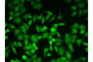 Immunofluorescent staining of HeLa cells with Glo1 monoclonal antibody, clone 6F10 . (GLO1 Antikörper)