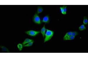 Immunofluorescence staining of HepG2 cells with ABIN7145113 at 1:133, counter-stained with DAPI. (ATG2B Antikörper  (AA 1357-1536))
