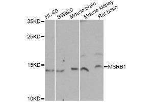 Western blot analysis of extracts of various cell lines, using MSRB1 Antibody (ABIN2559877) at 1:1000 dilution. (MSRB1 Antikörper)