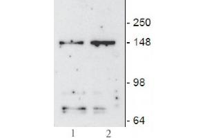 JMJD3/ KDM6B mAb (Clone 67-A2) tested by Western blot. (Kdm6b Antikörper  (AA 1028-1684))