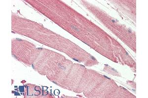 ABIN5539899 (5µg/ml) staining of paraffin embedded Human Skeletal Muscle.
