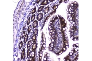 IHC testing of FFPE rat small intestine tissue with Glutathione Reductase antibody at 1ug/ml. (Glutathione Reductase Antikörper)