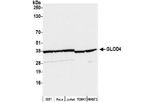 Western Blotting (WB) image for anti-Glyoxalase Domain Containing 4 (GLOD4) (AA 263-313) antibody (ABIN7452659)