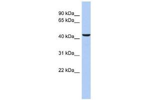 DFFB antibody used at 1 ug/ml to detect target protein. (DFFB Antikörper)