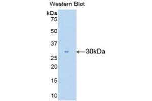 Western Blotting (WB) image for anti-Carbonic Anhydrase II (CA2) (AA 5-258) antibody (ABIN1858211) (CA2 Antikörper  (AA 5-258))