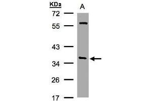 WB Image Sample(30 ug whole cell lysate) A:Hep G2 , 10% SDS PAGE antibody diluted at 1:1000 (NAPA Antikörper  (Center))