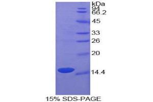 SDS-PAGE (SDS) image for Uncoupling Protein 2 (Mitochondrial, Proton Carrier) (UCP2) (AA 99-216) protein (His tag) (ABIN1981096)