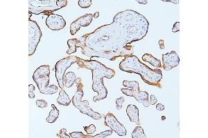 IHC analysis of MMP1 using anti-MMP1 antibody (ABIN7599873).