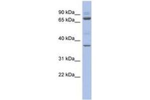 Image no. 1 for anti-Metal Response Element Binding Transcription Factor 2 (MTF2) (AA 359-408) antibody (ABIN6742455) (MTF2 Antikörper  (AA 359-408))