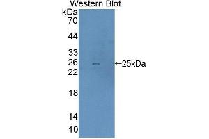Detection of Recombinant DTNBP1, Mouse using Polyclonal Antibody to Dystrobrevin Binding Protein 1 (DTNBP1) (DTNBP1 Antikörper  (AA 179-319))