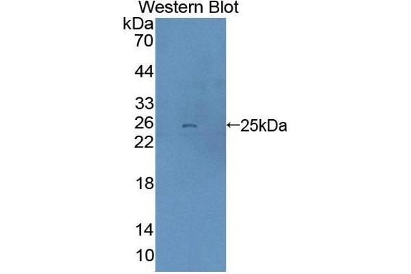 DTNBP1 抗体  (AA 179-319)
