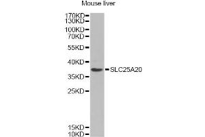 Western blot analysis of extracts of mouse liver, using SLC25A20 Antibody (ABIN6291312) at 1:1000 dilution. (SLC25A20 Antikörper)