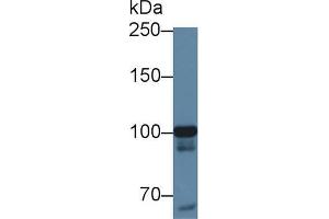 Western blot analysis of Human HeLa cell lysate, using Human MARS Antibody (1 µg/ml) and HRP-conjugated Goat Anti-Rabbit antibody ( (MARS Antikörper  (AA 74-198))