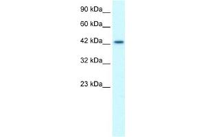 Human Jurkat; WB Suggested Anti-LHX3 Antibody Titration: 1. (LHX3 Antikörper  (Middle Region))