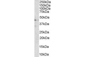 Western Blotting (WB) image for anti-AT-Hook Transcription Factor (AKNA) (C-Term) antibody (ABIN2790351) (AKNA Antikörper  (C-Term))
