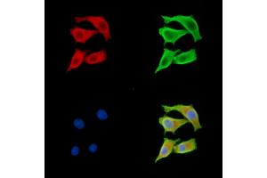 anti-Agouti Related Protein Homolog (Mouse) (AGRP) antibody