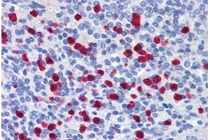 Human Spleen: Formalin-Fixed, Paraffin-Embedded (FFPE) (GCC2 Antikörper  (AA 1174-1185))