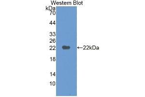 Detection of Recombinant M6PR, Human using Polyclonal Antibody to Mannose-6-Phosphate Receptor (M6PR) (M6PR Antikörper  (AA 27-185))