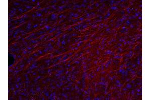 Indirect immunostaining of PFA fixed mouse brain section (dilution 1 : 500; red). (MBP Antikörper)