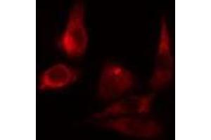 ABIN6275492 staining LOVO cells by IF/ICC. (ARHGAP9 Antikörper  (Internal Region))