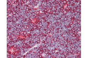 Human Thymus: Formalin-Fixed, Paraffin-Embedded (FFPE)