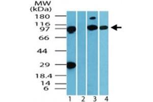 Western blot analysis of IQWD1 in human muscle tissue lysate in the 1) absence and 2) presence of immunizing peptide, 3) mouse muscle tissue lysate and 4) rat muscle tissue lysate. (DCAF6 Antikörper  (AA 800-850))