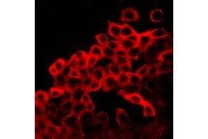 Immunofluorescent analysis of BAX staining in LOVO cells. (BAX Antikörper  (C-Term))