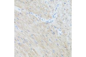Immunohistochemistry of paraffin-embedded mouse heart using CLUH antibody  at dilution of 1:100 (40x lens). (CLUH Antikörper  (AA 1120-1309))