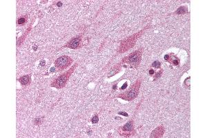 Anti-TMED10 / TMP21 antibody IHC of human brain, cortex. (TMED10 Antikörper  (Internal Region))