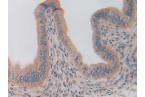 Immunohistochemistry (IHC) image for anti-Olfactomedin 4 (OLFM4) (AA 238-500) antibody (ABIN7431236)