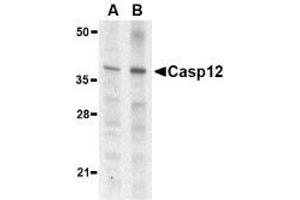 Western blot analysis of caspase-12 in mouse (lane A) and rat (lane B) liver lysate with AP30193PU-N caspase-12 antibody (small) at 1 μg/ml. (Caspase 12 Antikörper  (small))