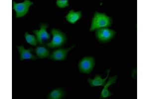 Immunofluorescence staining of A549 cells with ABIN7160660 at 1:50, counter-stained with DAPI. (MTMR9 Antikörper  (AA 322-549))
