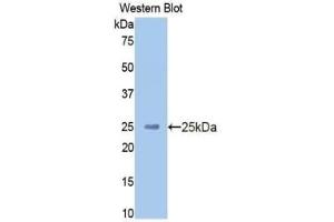 Detection of Recombinant HMWK, Human using Polyclonal Antibody to High Molecular Weight Kininogen (HMWK) (Kininogen (HMW) Antikörper  (AA 225-407))