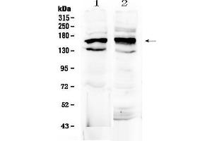 Western blot analysis of FMN1 using anti-FMN1 antibody . (FMN1 Antikörper  (AA 1195-1419))