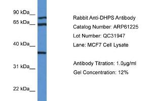 Western Blotting (WB) image for anti-Deoxyhypusine Synthase (DHPS) (N-Term) antibody (ABIN786367) (DHPS Antikörper  (N-Term))